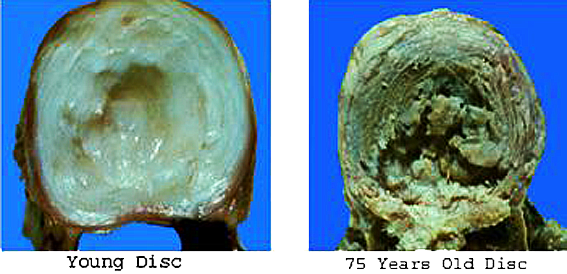 Techlamed Discolux Cervicale