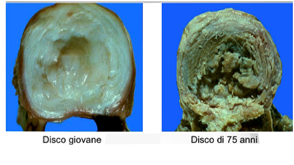 Techlamed Discolux Cervicale