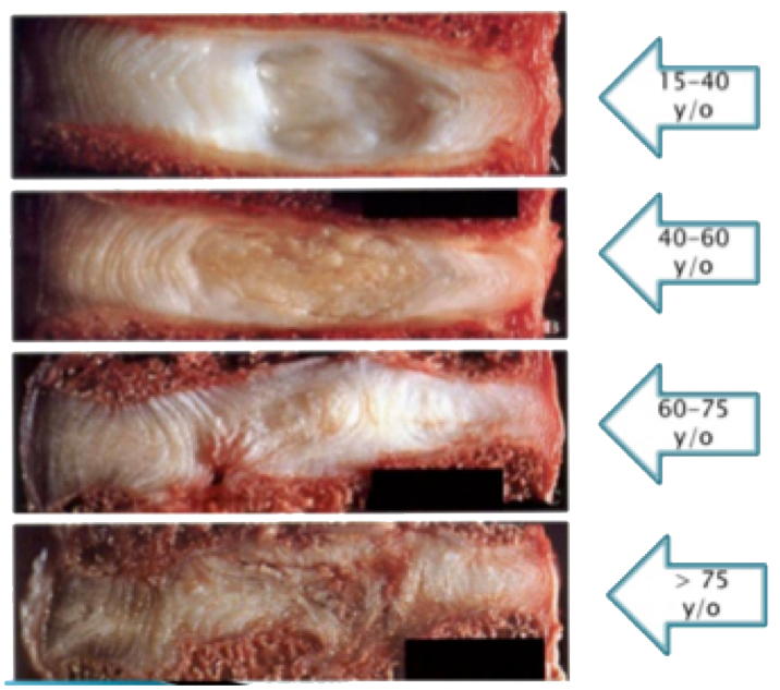 Techlamed Discolux Cervicale