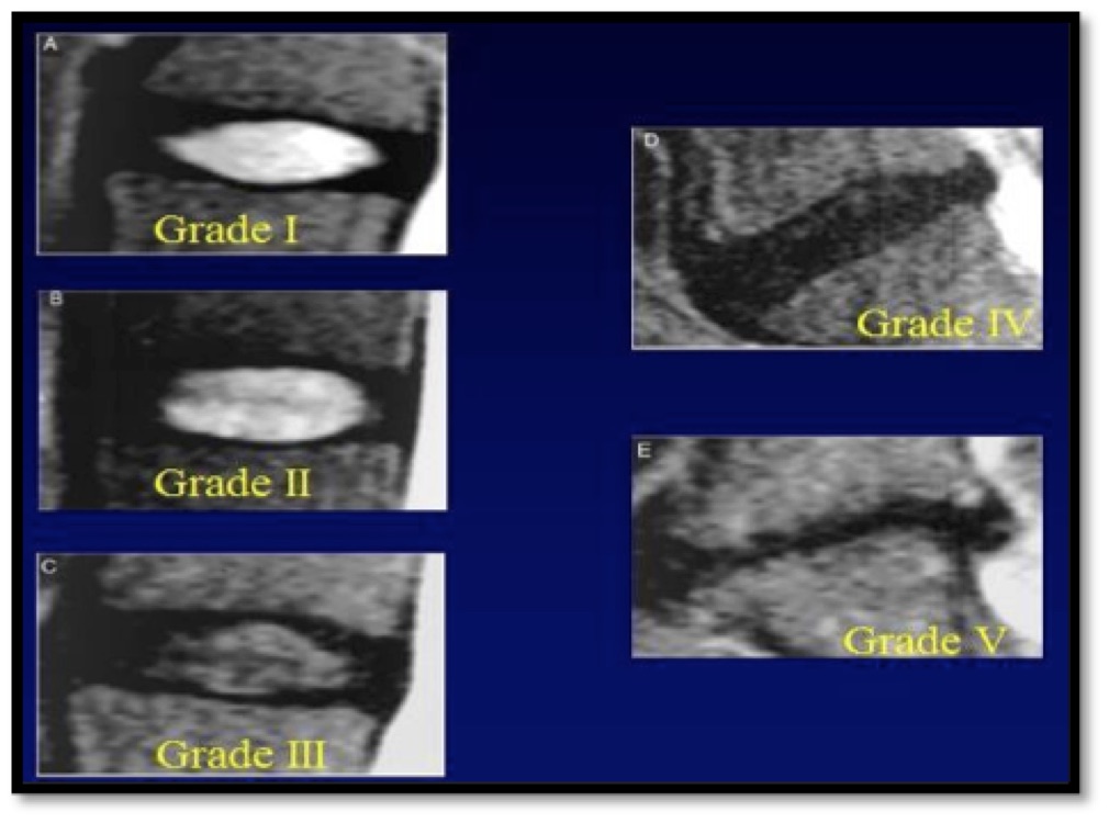 Techlamed Discolux Cervicale