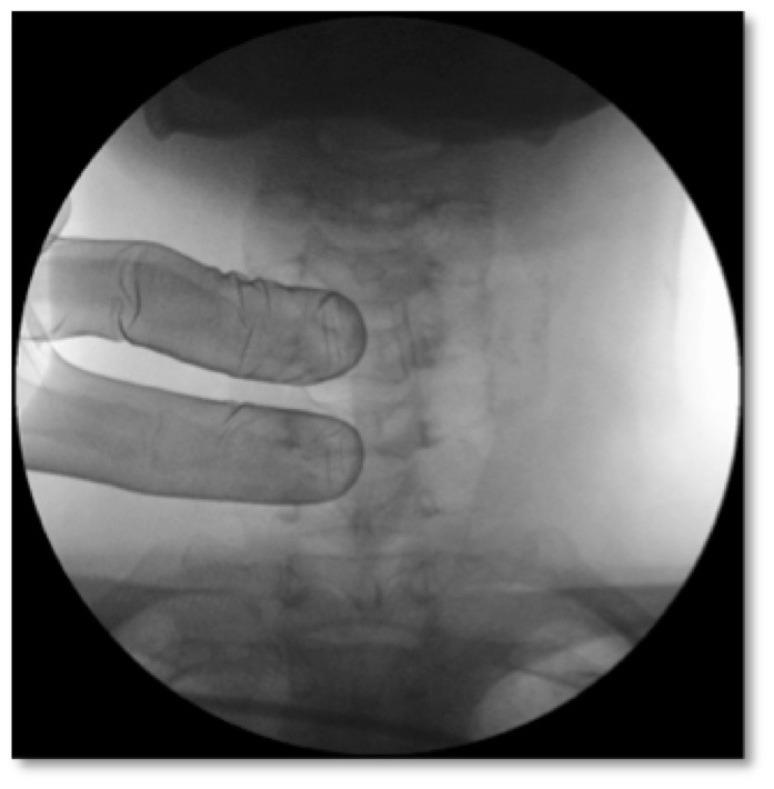 Techlamed Discolux Cervicale