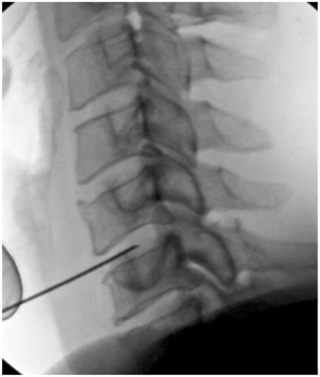Techlamed Discolux Cervicale