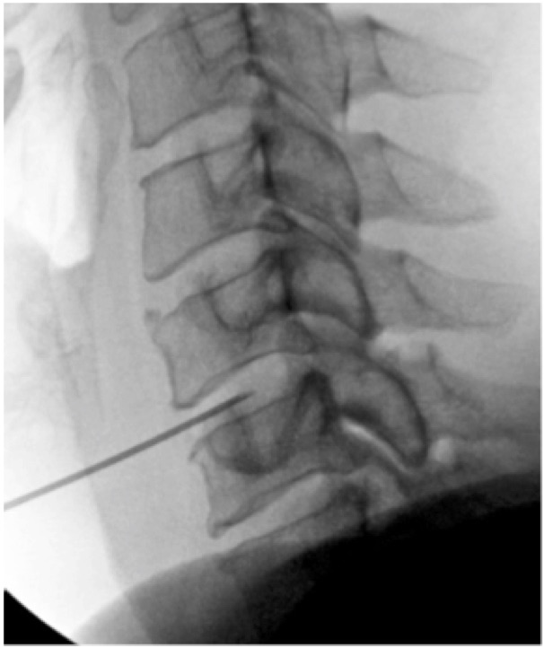 Techlamed Discolux Cervicale